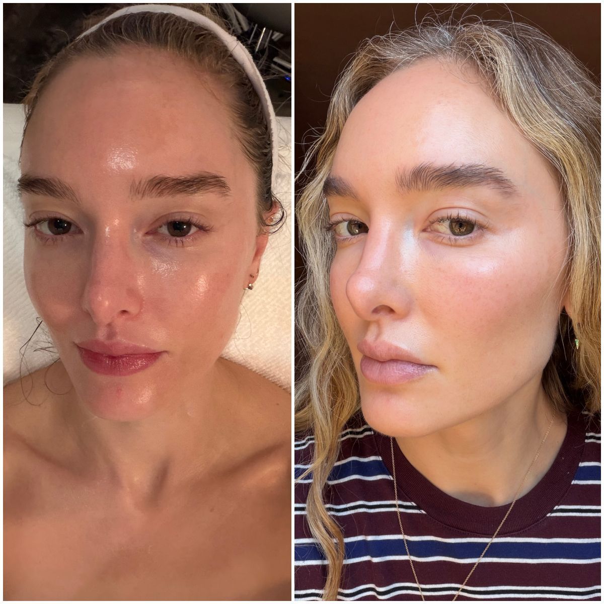 Featured image 10 Skincare Products for Glowing Skin from Dermstore Sale