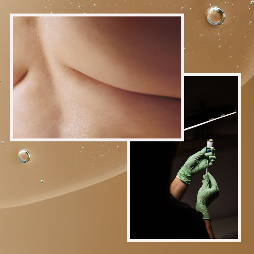 Featured image DIY Liposuction Trend Plastic Surgeons Are Not Amused