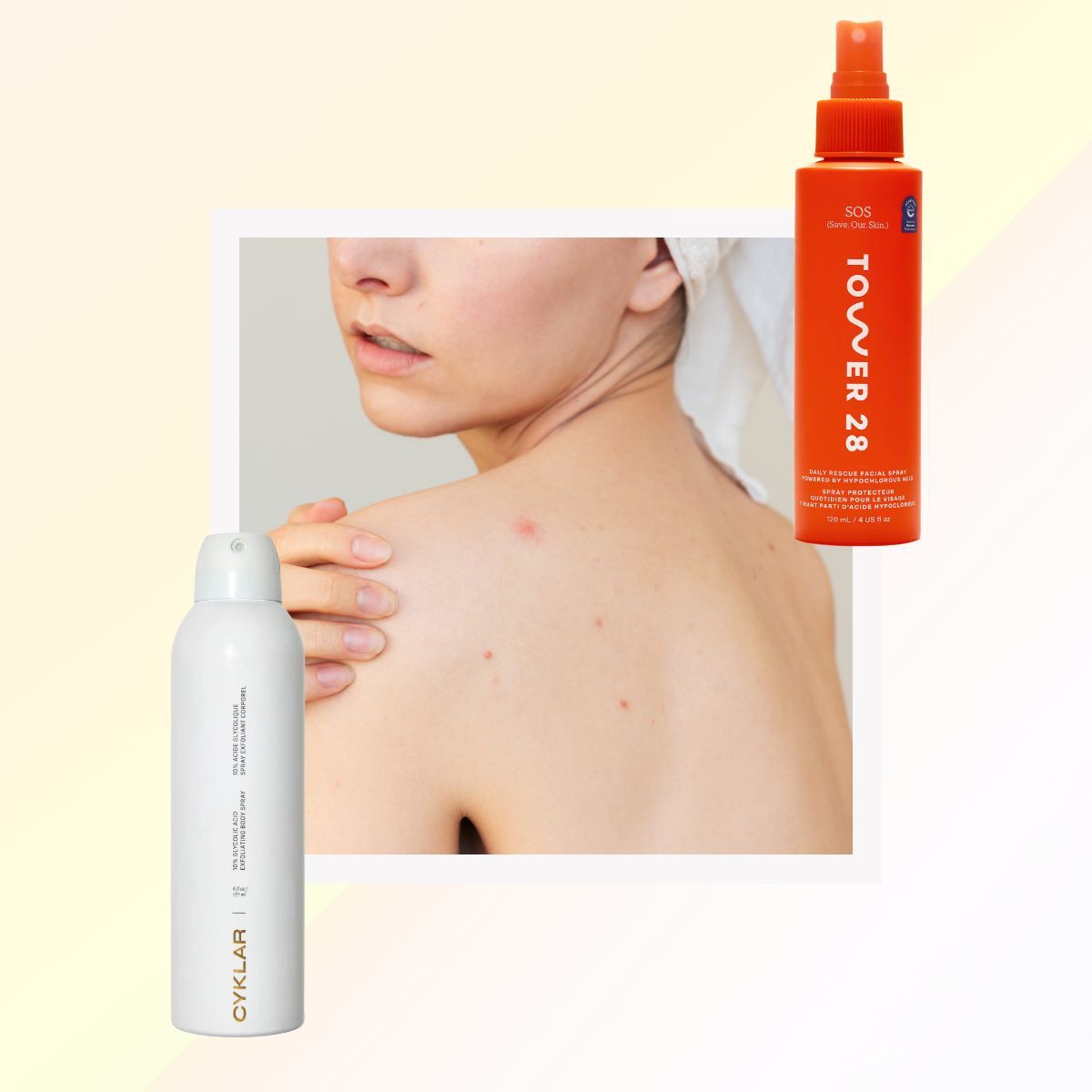 Featured image 10 Body Acne Products for Chest Back Butt  All Hot Spots