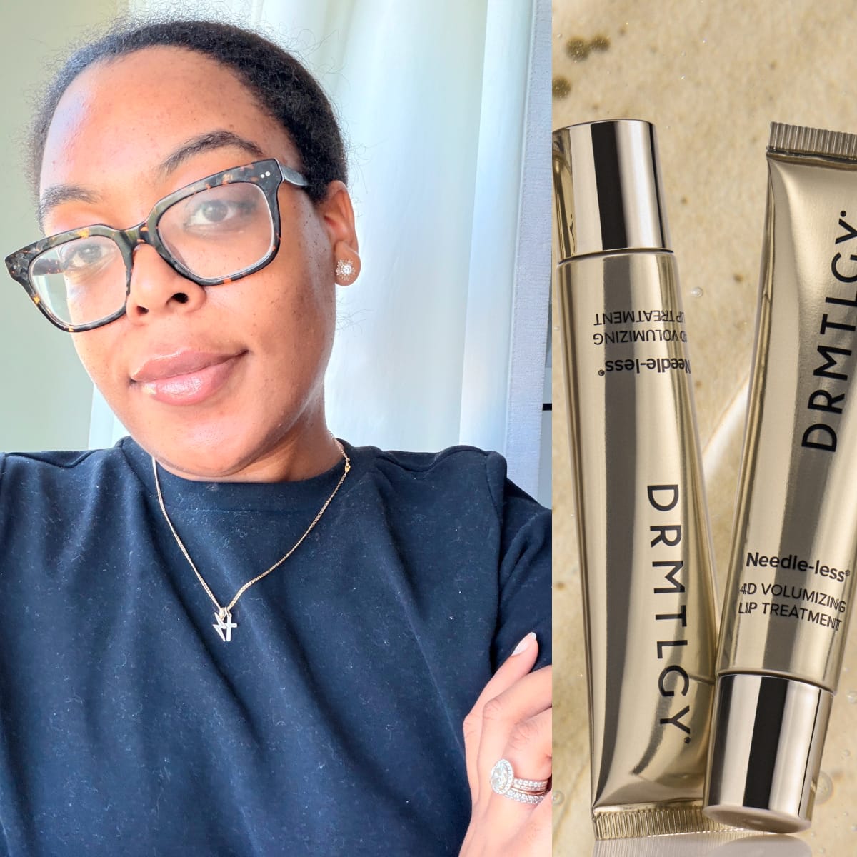 Featured image Ditching Lip Filler for Plumper Lips DRMTLGY 4D